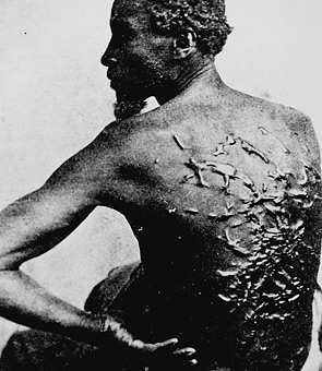 A slave who has been severely wipped